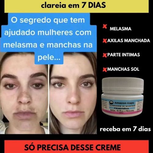 ✨ Cuide da sua pele como ela merece com o poder da natureza do Amazolê 749754