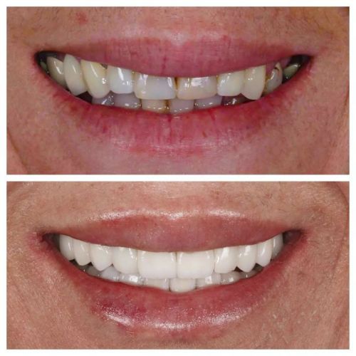 Cd3 Odontologia 761840