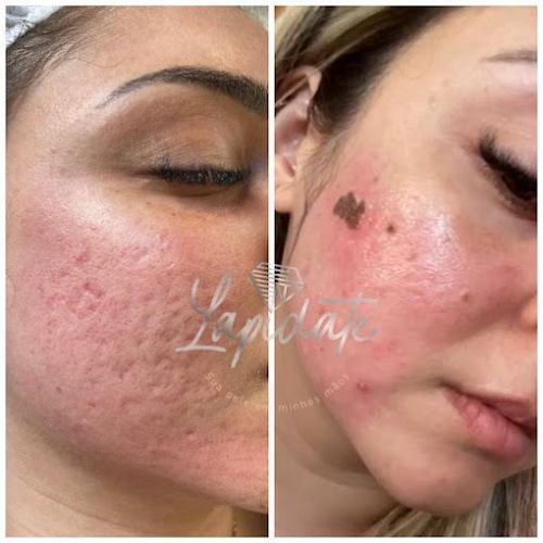 Centro De Estética Lapidate - Nucia Pires 768465 Centro De Estética Lapidate - Nucia Pires 768465