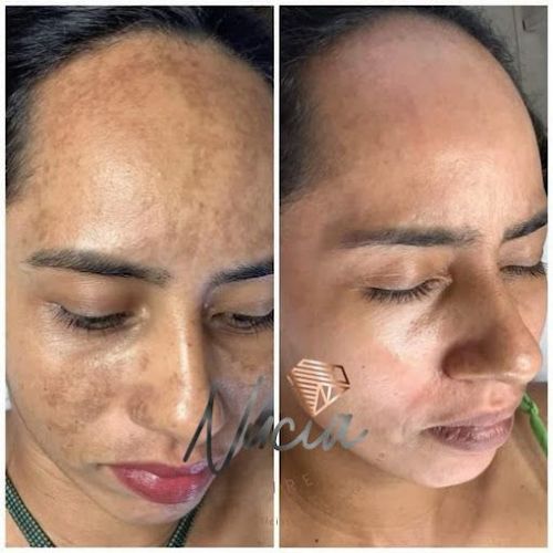 Centro De Estética Lapidate - Nucia Pires 768467 Centro De Estética Lapidate - Nucia Pires 768467