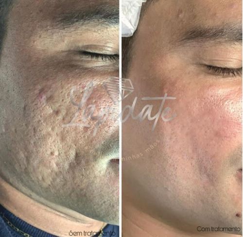 Centro De Estética Lapidate - Nucia Pires 768468 Centro De Estética Lapidate - Nucia Pires 768468