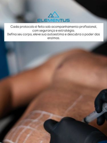 Clínica Elementus - Depilação Masculina 776621