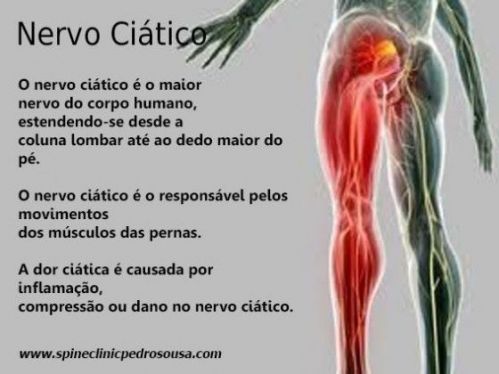Dor no nervo ciático - Massagem - Centro - São José Sc 617579