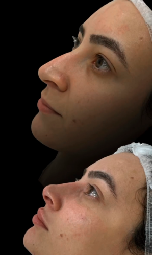 Dra Fernanda Siqueira - Harmonização Facial 750104