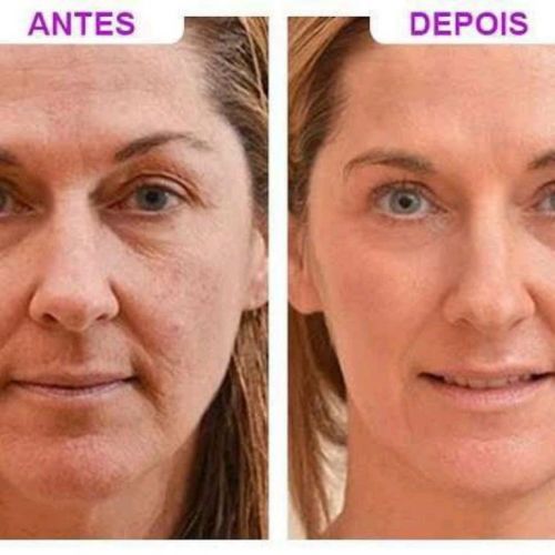 Drean colágeno  762156 Drean colágeno  762156