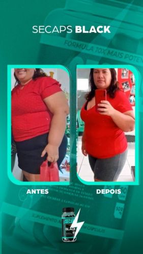 Emagreça Rápido com Suplemento natural  750553