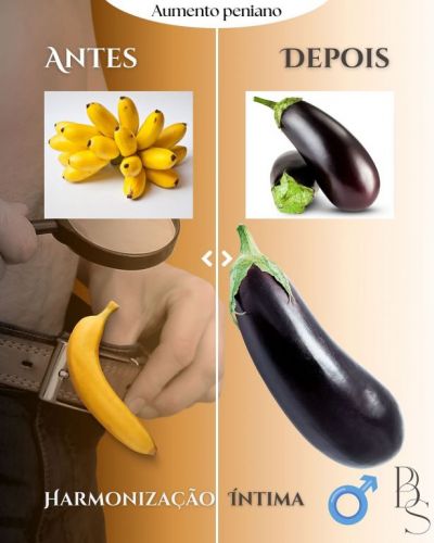 Harmonização corporal e facial Promoção  762718