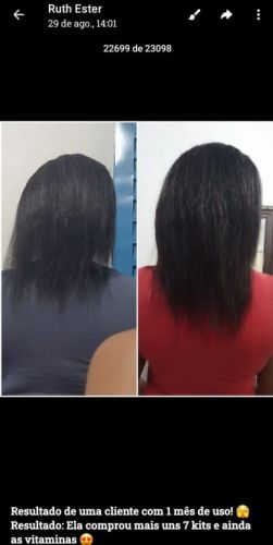 kit com 3 produtos s.o.s crescimento capilar 759214