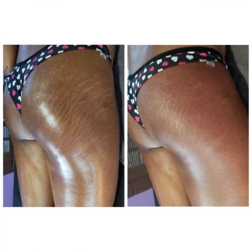 Massagens e terapias para dores musculares relaxamento e emagrecimento  741612
