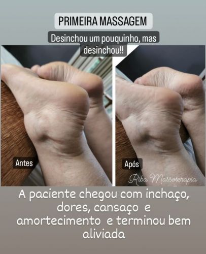 Massagens e terapias para dores musculares relaxamento e emagrecimento  741615