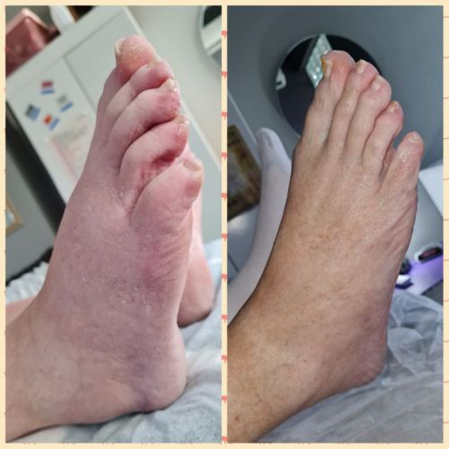 Massagens e terapias para dores musculares relaxamento e emagrecimento  741616