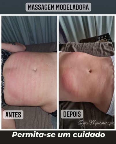 Massagens e terapias para dores musculares relaxamento e emagrecimento  741619