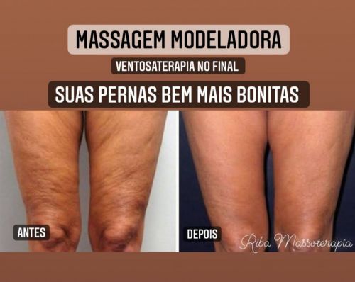 Massagens e terapias para dores musculares relaxamento e emagrecimento  741620