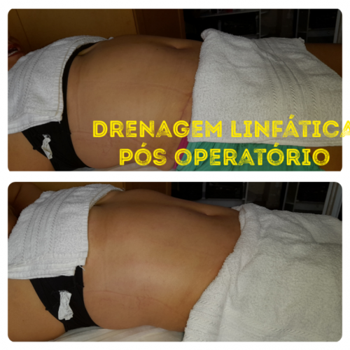 Massoterapeuta  775835