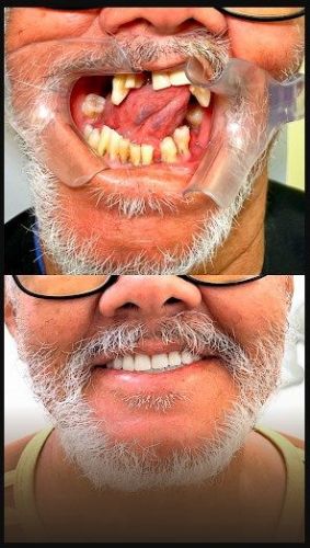 Odonto Premium Santo Hilário 772547