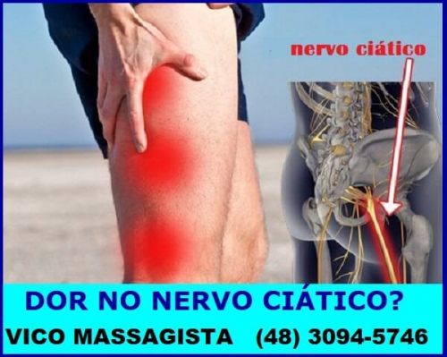 Quiropraxia para nervo ciático em São José Sc 578986