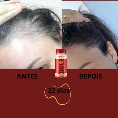  Tratamento Natural para Cabelos Unhas e Pele 750555