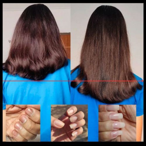  Tratamento Natural para Cabelos Unhas e Pele 750557